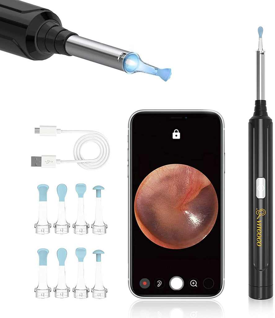 Buy Wholesale China 2023 Suear X9 Wifi 5mp Mini Otoscope Video Ear Candle  Wax Removal Tool With Led Light & Ear Camera at USD 8.3